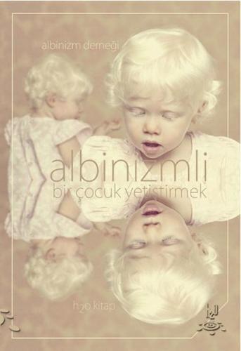 Albinizmli Bir Çocuk Yetiştirmek Kolektif